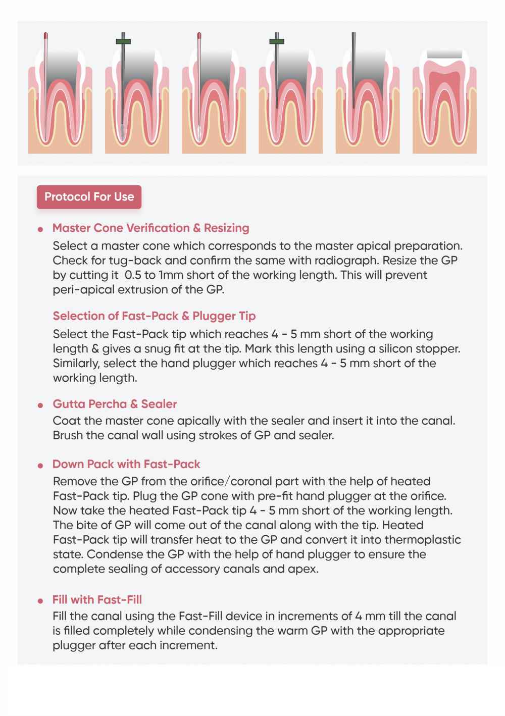 Eighteeth Fast Pack 3D Obturation System / Dental Equipment