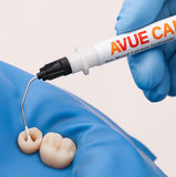 Dental Avenue AvueCal Calcium Hydroxide Paste / Temporary Filling Material