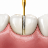 Prima Dental Predator Accuprep Crown Preparation Carbides Kit
