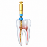 Coltene HyFlex Remover Retreatment Rotary Files 23mm | NiTi Endodontic Files