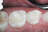 GI Core 