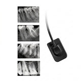 Woodpecker RVG i-Sensor