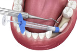 Advance Biotech Osseograft DMBM Bone Graft / De-Mineralized Bone Collagen
