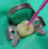 total etch bonding agent dental