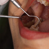 PMT Set of 3 Instrument Kit 