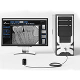 Eighteeth Nanopix X-Ray Intraoral RVG Sensor