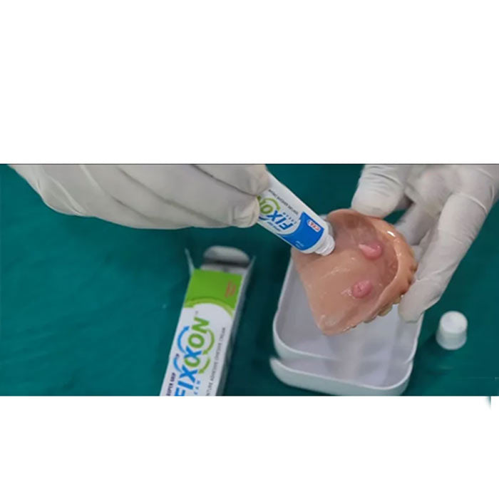 ICPA Fixon Cream Denture Adhesive Relining Material (Pack of 5)